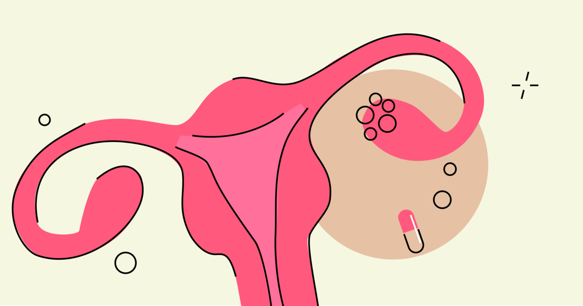 mechanism of metformin in pcos